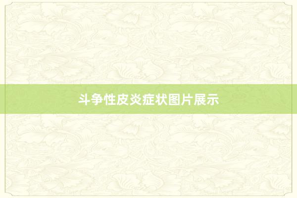 斗争性皮炎症状图片展示